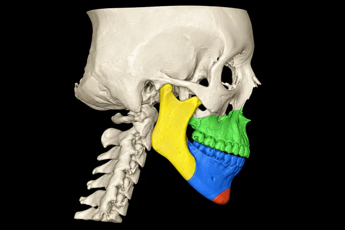 Reconstrucción 3D del cráneo y los maxilares para planificar la cirugía — Clínica Proface