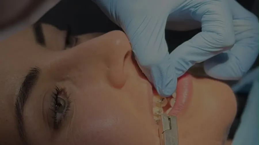 Ortodoncia — Clínica Proface